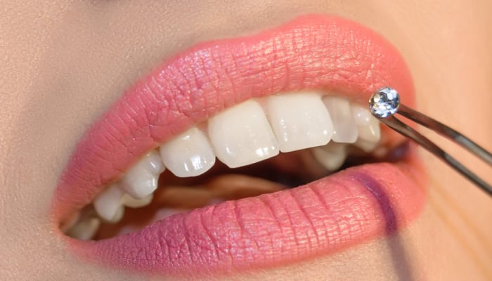 Tooth Jewel Application at Avitor Dental