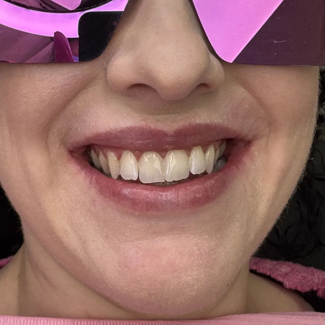 mobile dental services for nursing homes